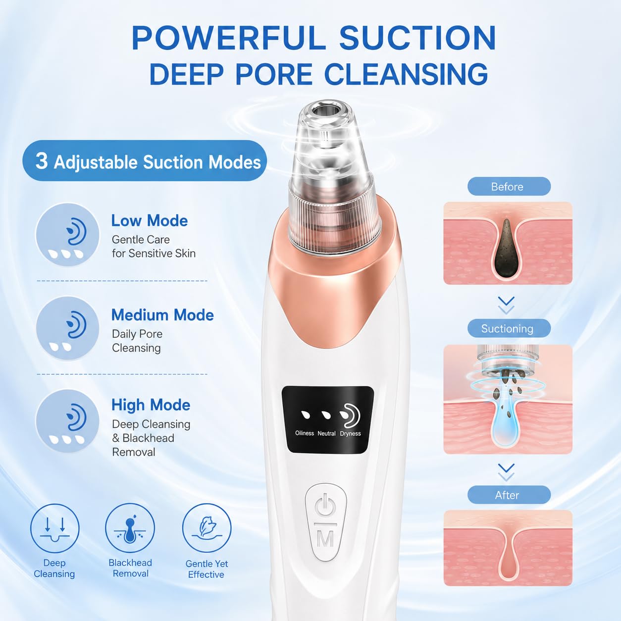 Pore Vacuum - Rechargeable Blackhead Remover with 5 Suction Heads | Adjustable Suction Levels & Stainless Steel Tools - At-Home Skincare Kit