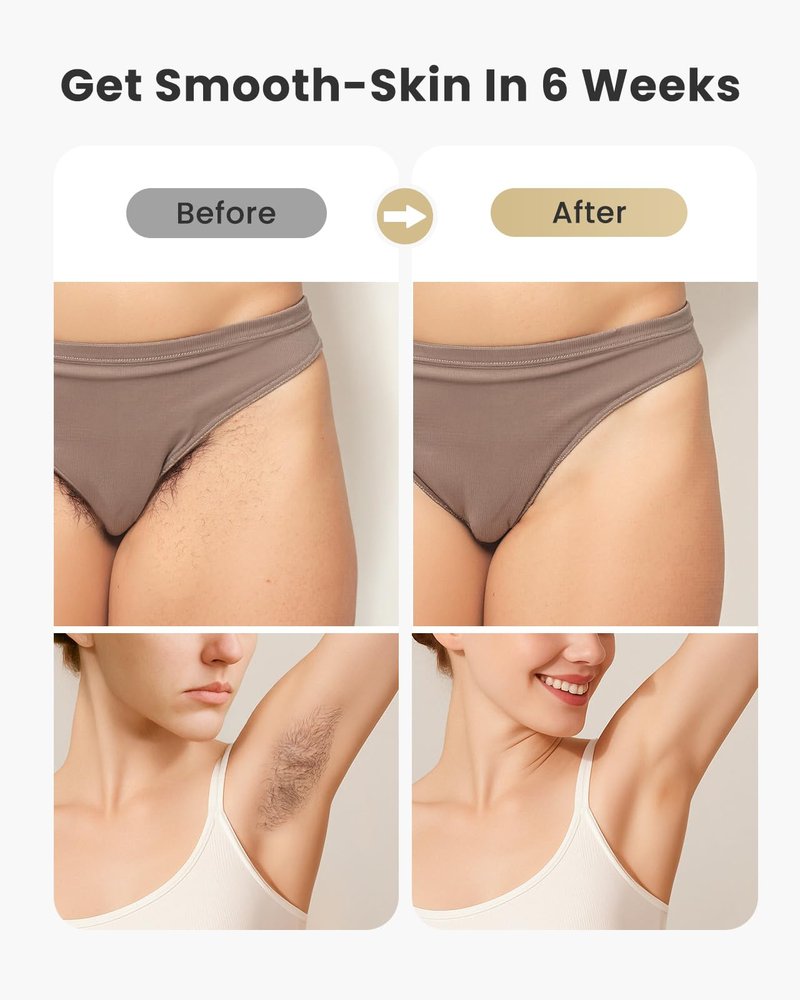 IPL Hair Removal Device for Women & Men, At Home Use Personal Device Hair Removal for Body, for Personal Use, Protective Eyewear Included, Models: A108