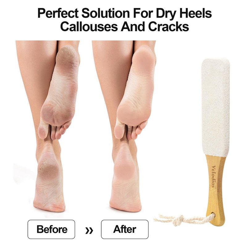 Foot File Foot Scrubber Pedicure, Pumice Stone for Feet, 2 Pack Professional Foot Scrubber Remove Cracked Heels,Dead Skin,Corn,Scraper File Foot Care Foot Rasp Massage Brush Tools Kit for Men/Women