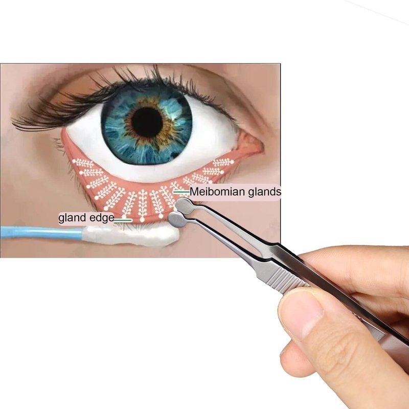 ZGORENDZ Premium Stainless Steel Arita Tauber Meibomian Gland Expressor Forceps Eyelid Massage Tweezers-Round Tip..