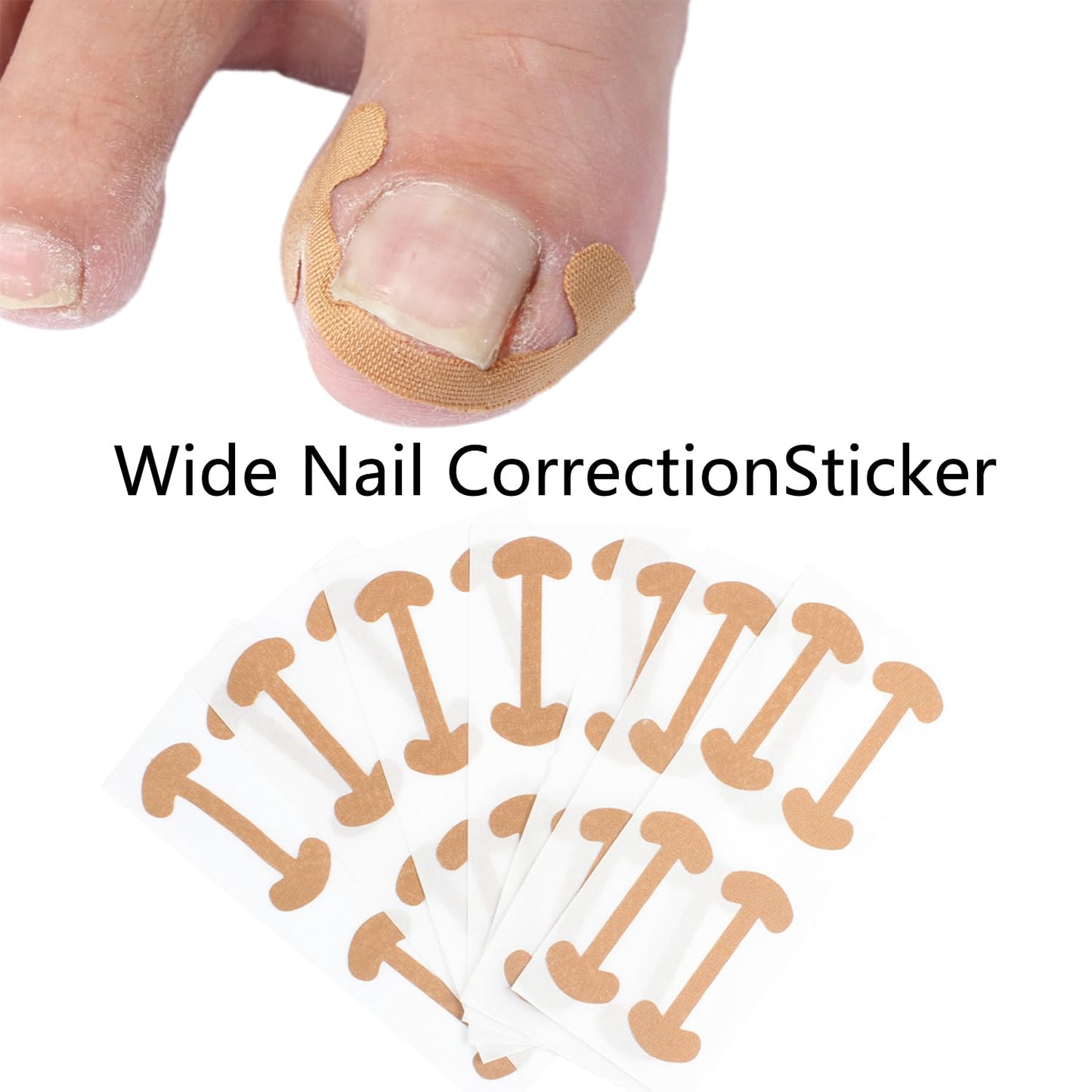 CHEMAILON Professional Ingrown Toenail Correction Kit - Stainless Steel Ingrown Toenail Clippers, Correction Patches, Lifter & Tools for Ingrown Toenail Treatment, Home Pedicure Solution