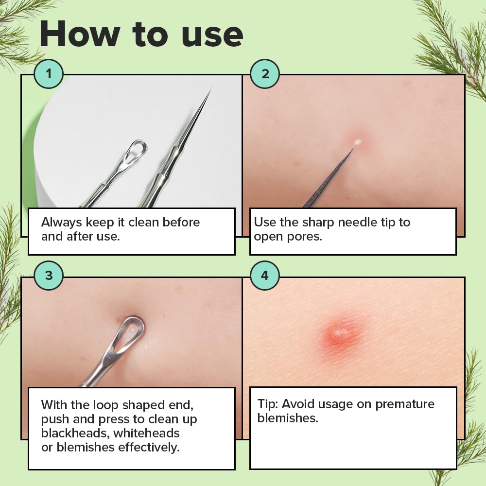 I DEW CARE Dual-Tip Pimple Tool - Proper Popper | Blackhead Remover, Blemish Exfoliating, Professional Acne Squeezer, Comedone Zit Extractor for Women, 2in1 Stainless Steel Lancet, 1ea