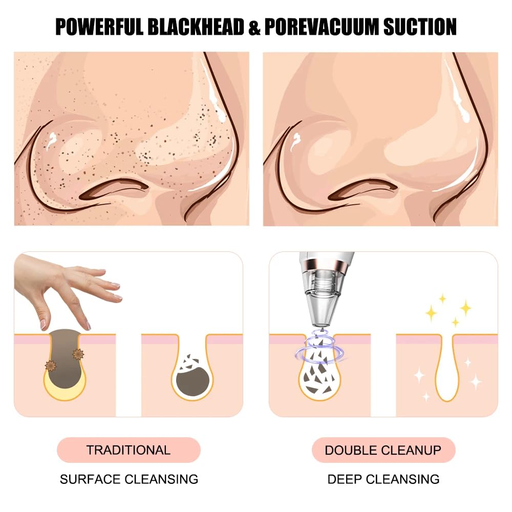 Blackhead Remover Pore Vacuum for Face & Nose, Blackhead Extractor with 3 Adjustable Suction Levels, 6 Removal Tools, USB Rechargeable Facial Pore Cleaner for Women & Men (White)