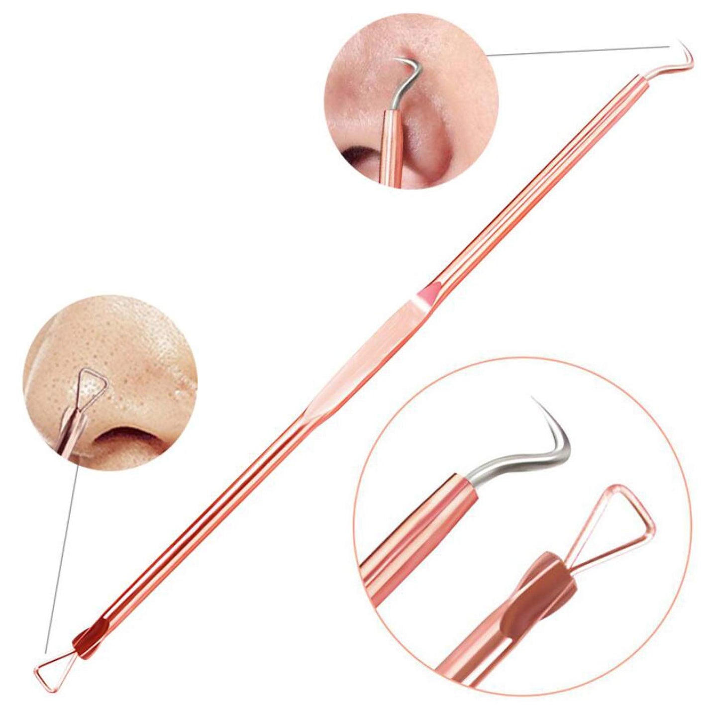 ZTRHYOO Blackhead Remover Pimple Comedone Extractor Tool Best Acne Removal Kit - Treatment for Blemish, Whitehead Popping, Zit Removing for Risk Free Nose Face Skin with Case (Rose)