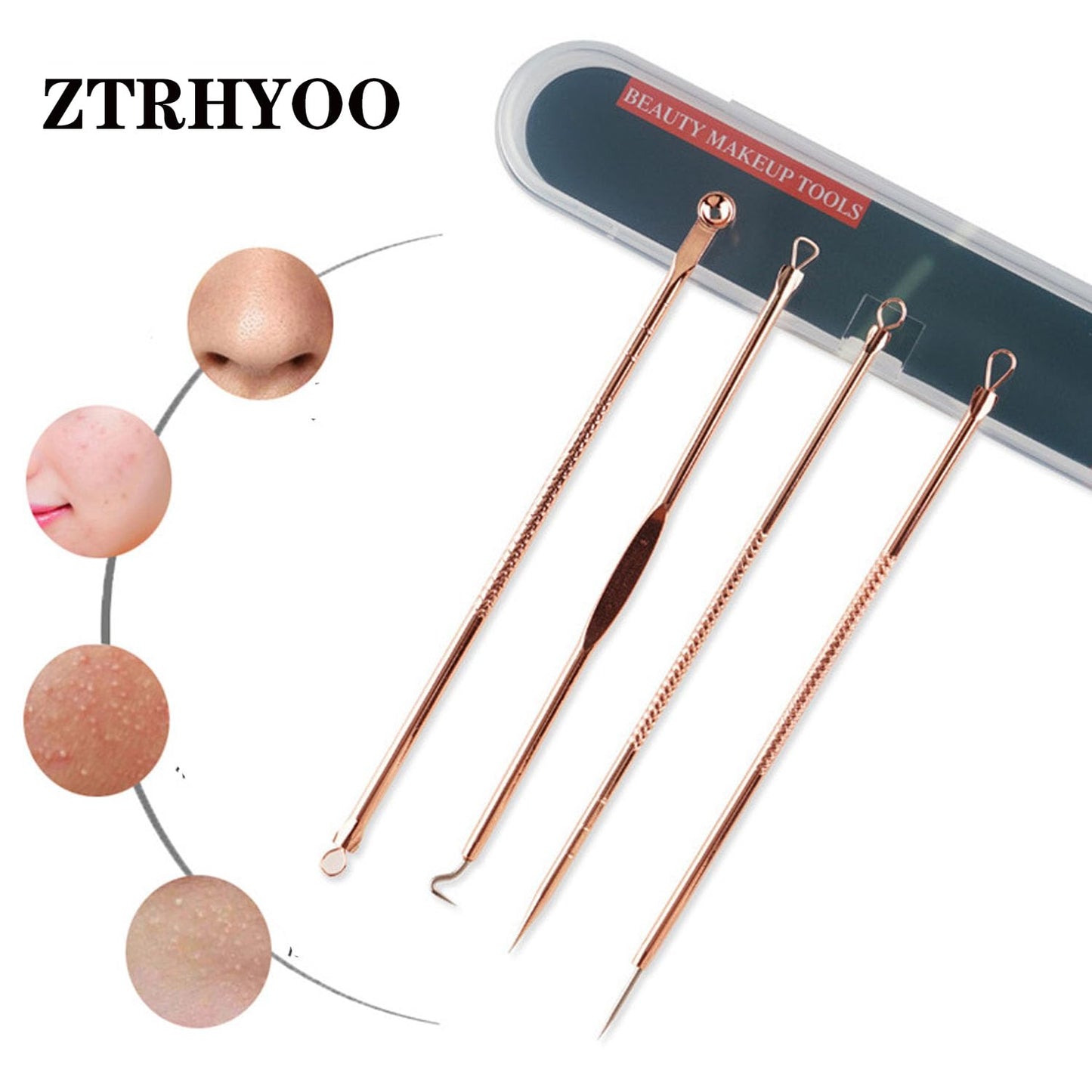 ZTRHYOO Blackhead Remover Pimple Comedone Extractor Tool Best Acne Removal Kit - Treatment for Blemish, Whitehead Popping, Zit Removing for Risk Free Nose Face Skin with Case (Rose)