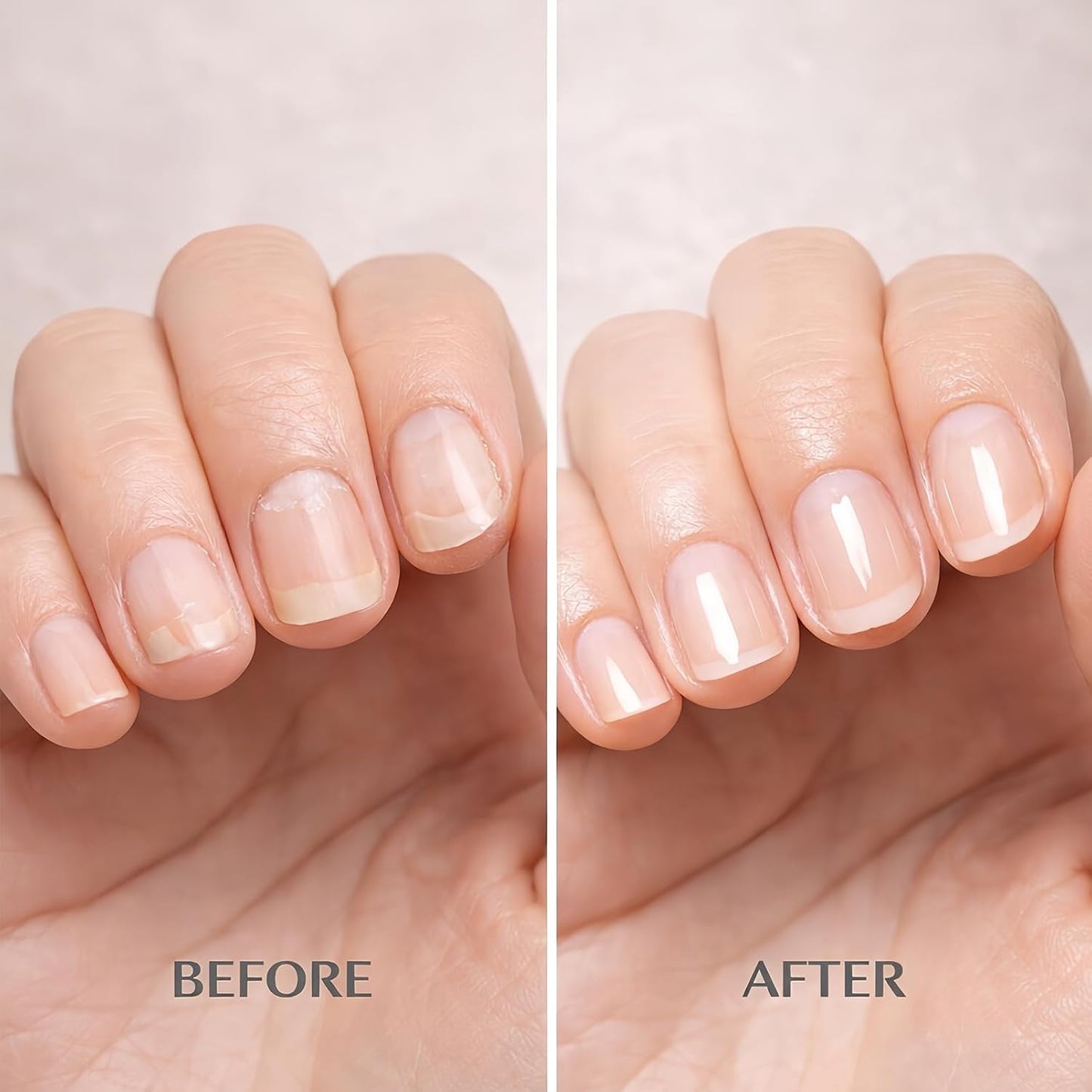 Nail Strengthening & Hydrating Oil - Clear Daily Care Solution for Weak Nails | 15ml Natural Gloss Finish
