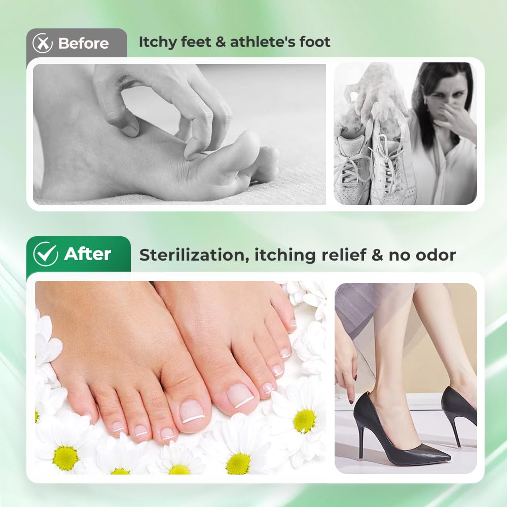 Foot Spray with Tea Tree Oil, Tea Tree Oil Feet Spray for Foot & Shoe Deodorizer Spray, Odor Control Quick Drying Freshener Odor Eliminator for Daily Feet Care (1pcs)