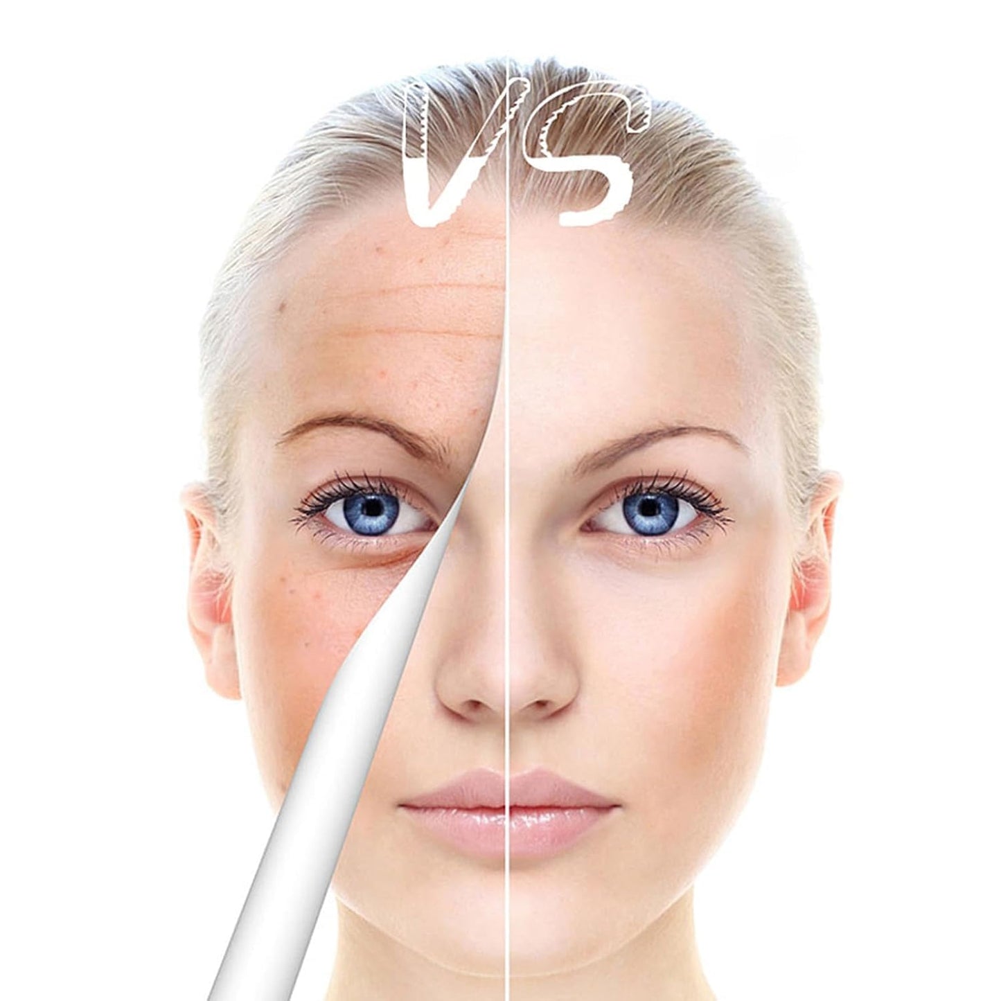 Derma Roller Pen - 0.25mm Microneedling Tool for At-Home Skin & Hair Care | Unisex Beauty Device