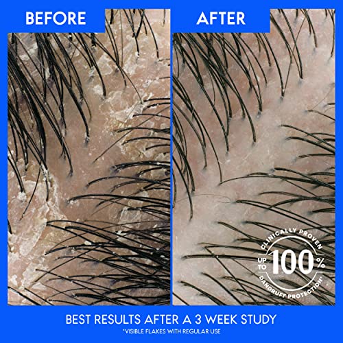 Head & Shoulders Smooth and Silky 2-in-1 Anti-Dandruff Shampoo