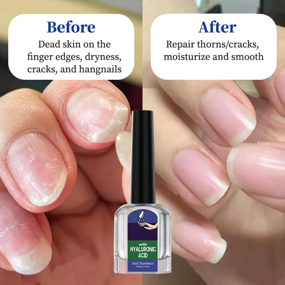 Nail Care Cuticle Oil - Fast Absorbing Repair Serum for Cracked Cuticles | 2-Pack for Home Manicures