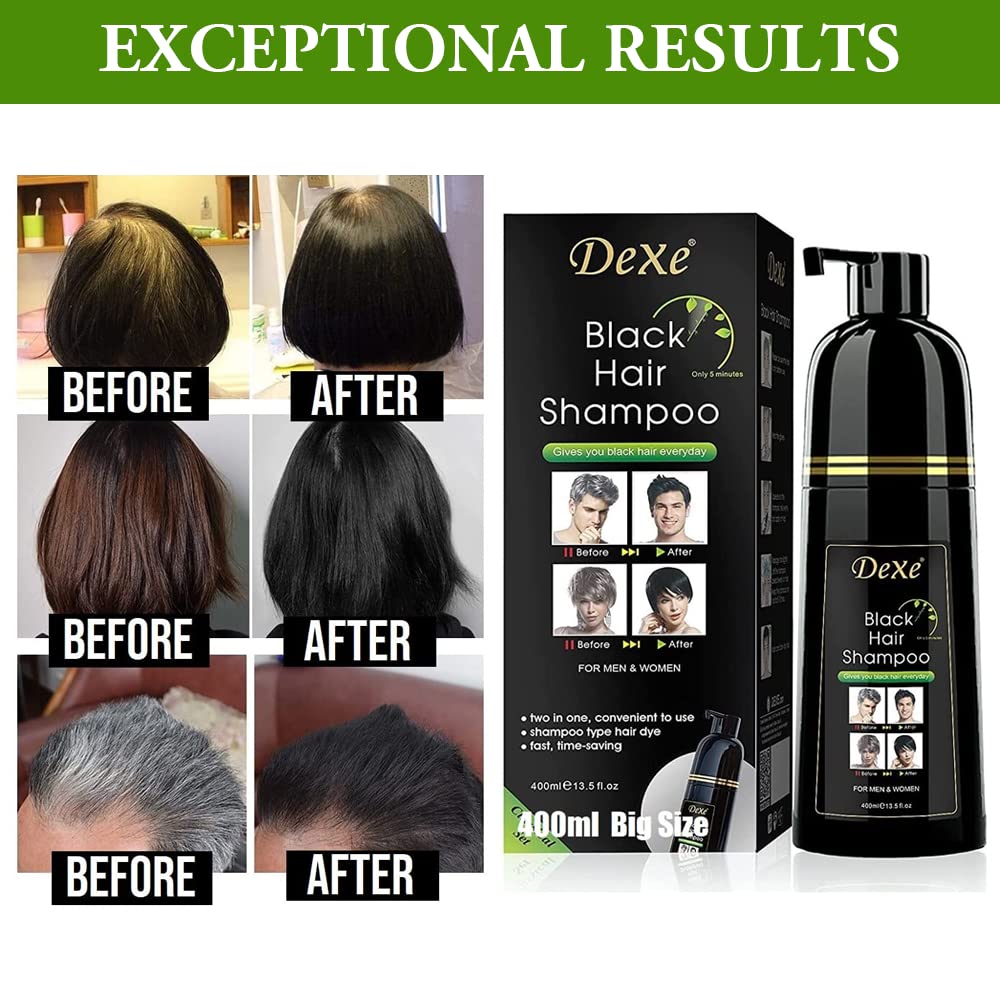 Dexe Hair Dye Shampoo - Black Hair Color for Men & Women | 14.1 Fl Oz Gray Coverage
