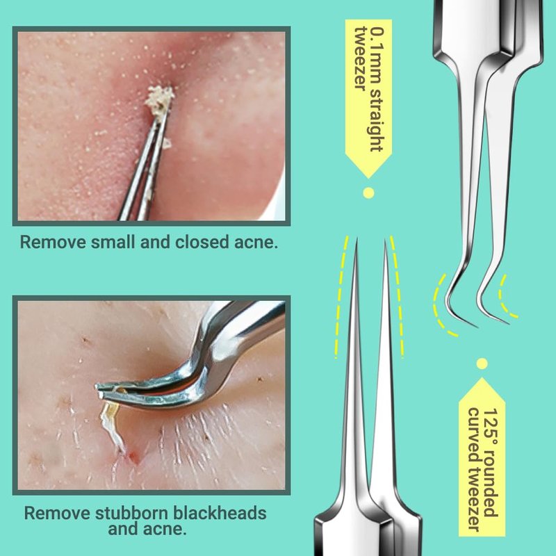 TsMADDTs Blackhead Remover Tools and Ingrown Hair Tweezers, 9 pcs Pimple Popper Tool Kit, Ingrown Hair Removal Kit with Pimple Extractor, Pore Extractor, Tweezers, Razor