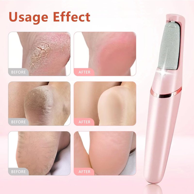 Electric Foot Callus Remover - Rechargeable Pedicure Tool for Smooth Feet Care | Ideal Gift in Pink