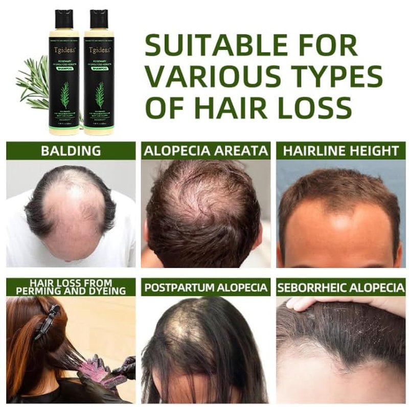 Organic Rosemary Hair Growth Shampoo - Natural Thickening & Strengthening Formula with Hydrolyzed Keratin | 7.4 fl. oz