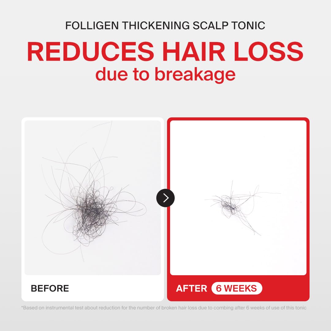 Dr.FORHAIR Folligen Tonic 4.06 fl oz | Scalp Serum for Hair Care | Scalp Care and Nourishment | Revitalizing Tonic for Healthy Scalp & Hair Thickening