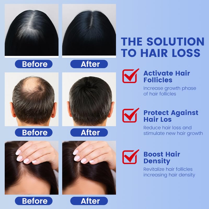 GHK-Cu Copper Peptide Hair Growth Serum - Strengthens Hair & Scalp, Reduces Thinning | 1.69 fl oz