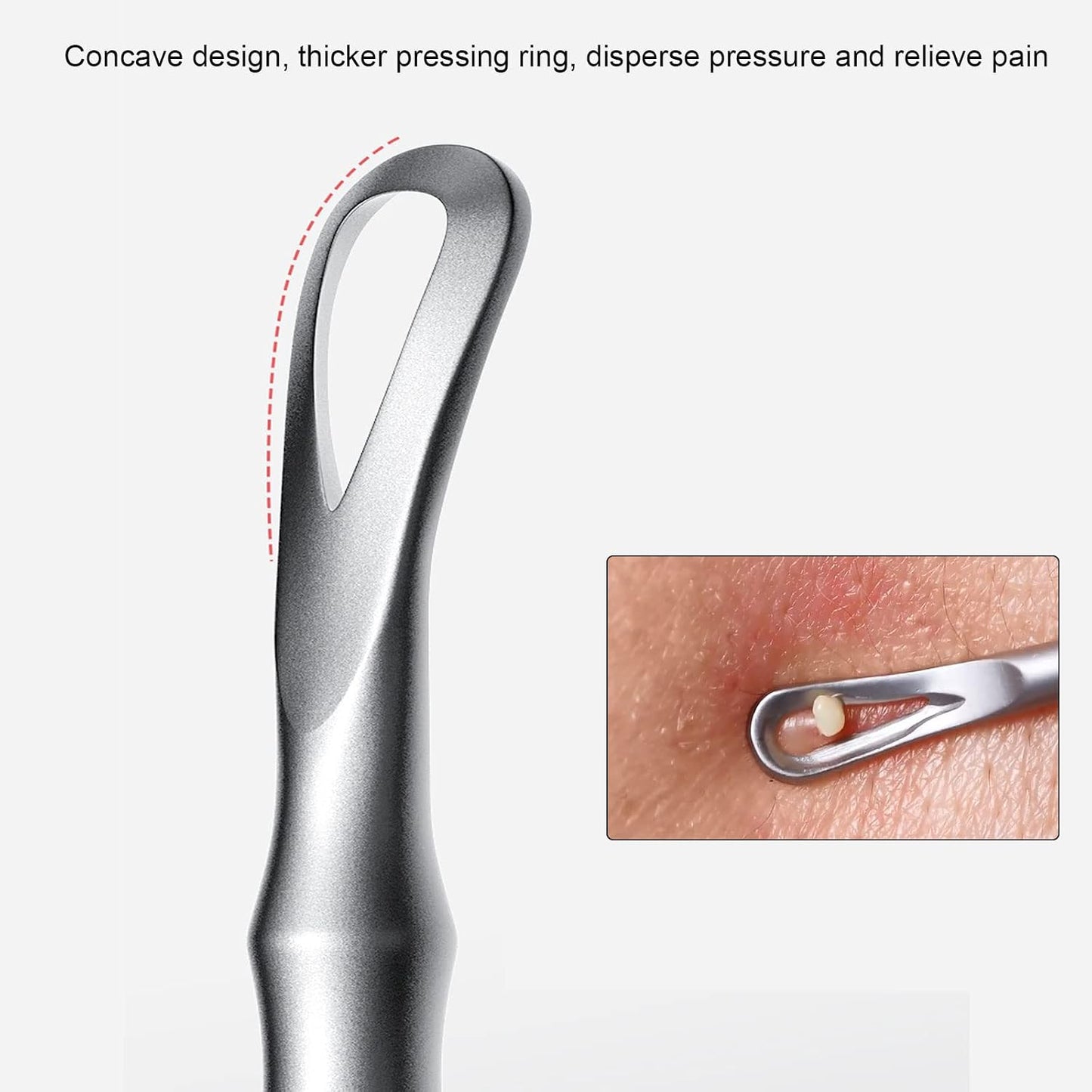 Pointed Blemish Removal Tool - 2-in-1 Stainless Steel Skin Care Remover for Face & Nose
