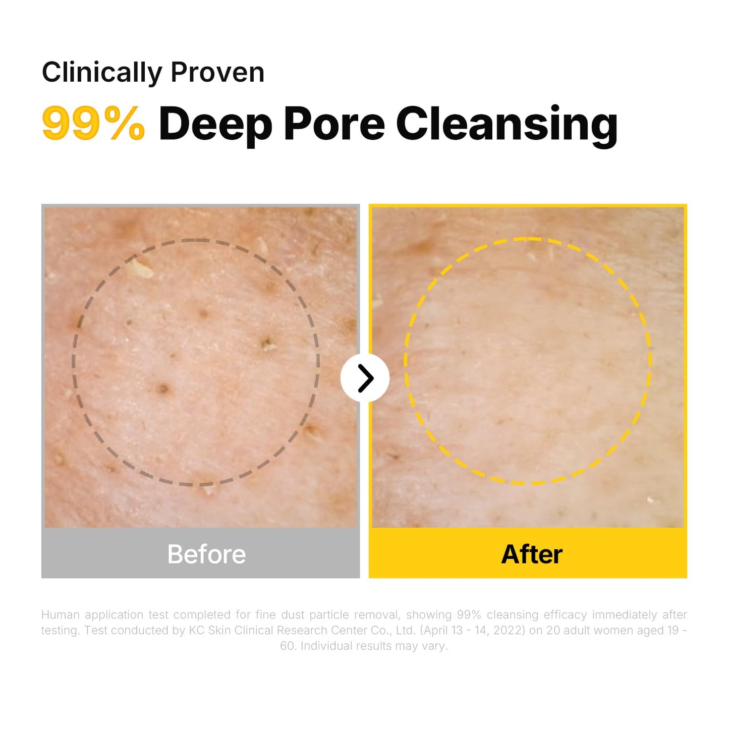 Pure Cleansing Oil - Natural Makeup Remover & Blackhead Solution | Korean Skin Care, 6.76 fl oz (200ml)