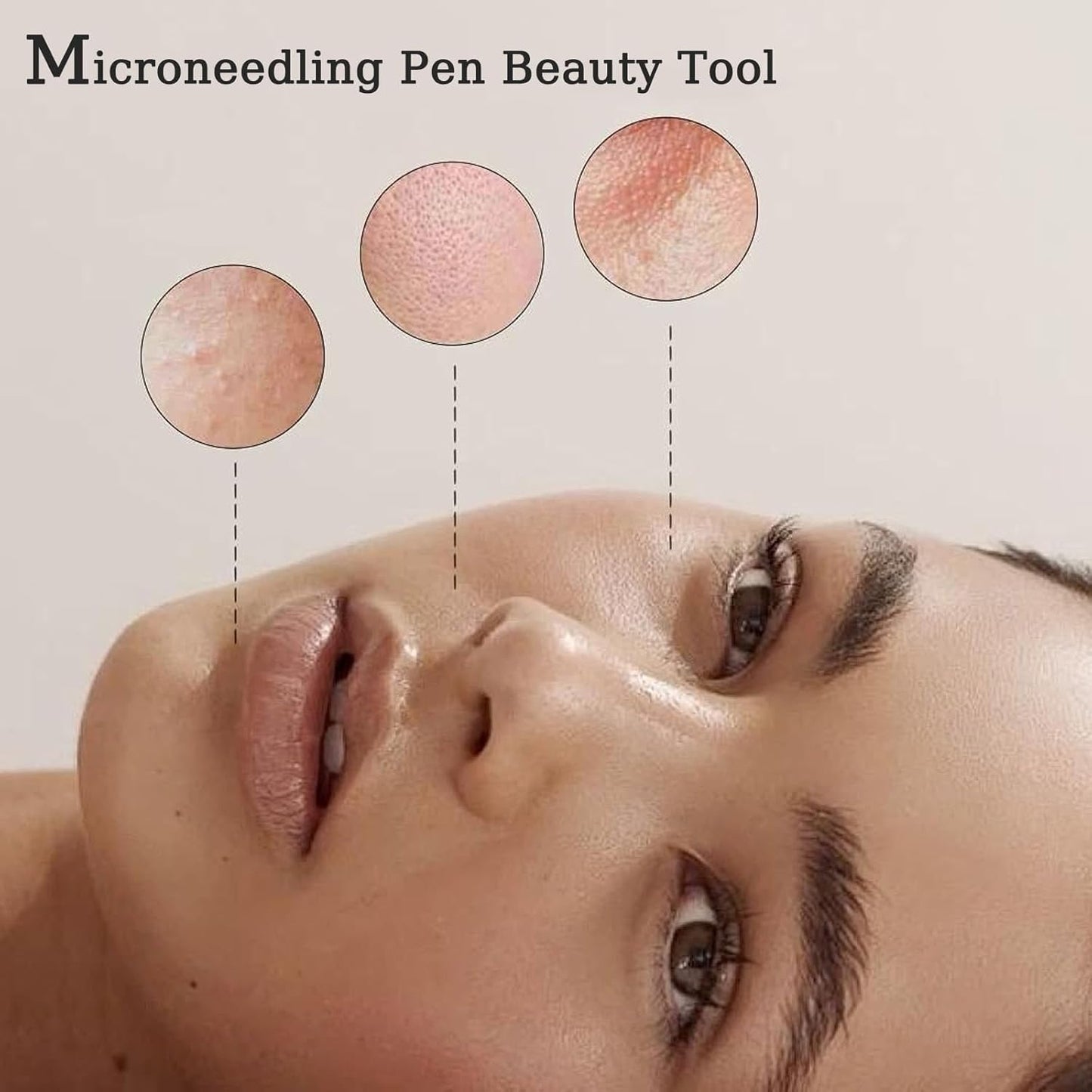 Derma Roller Pen - 0.25mm Microneedling Tool for At-Home Skin & Hair Care | Unisex Beauty Device