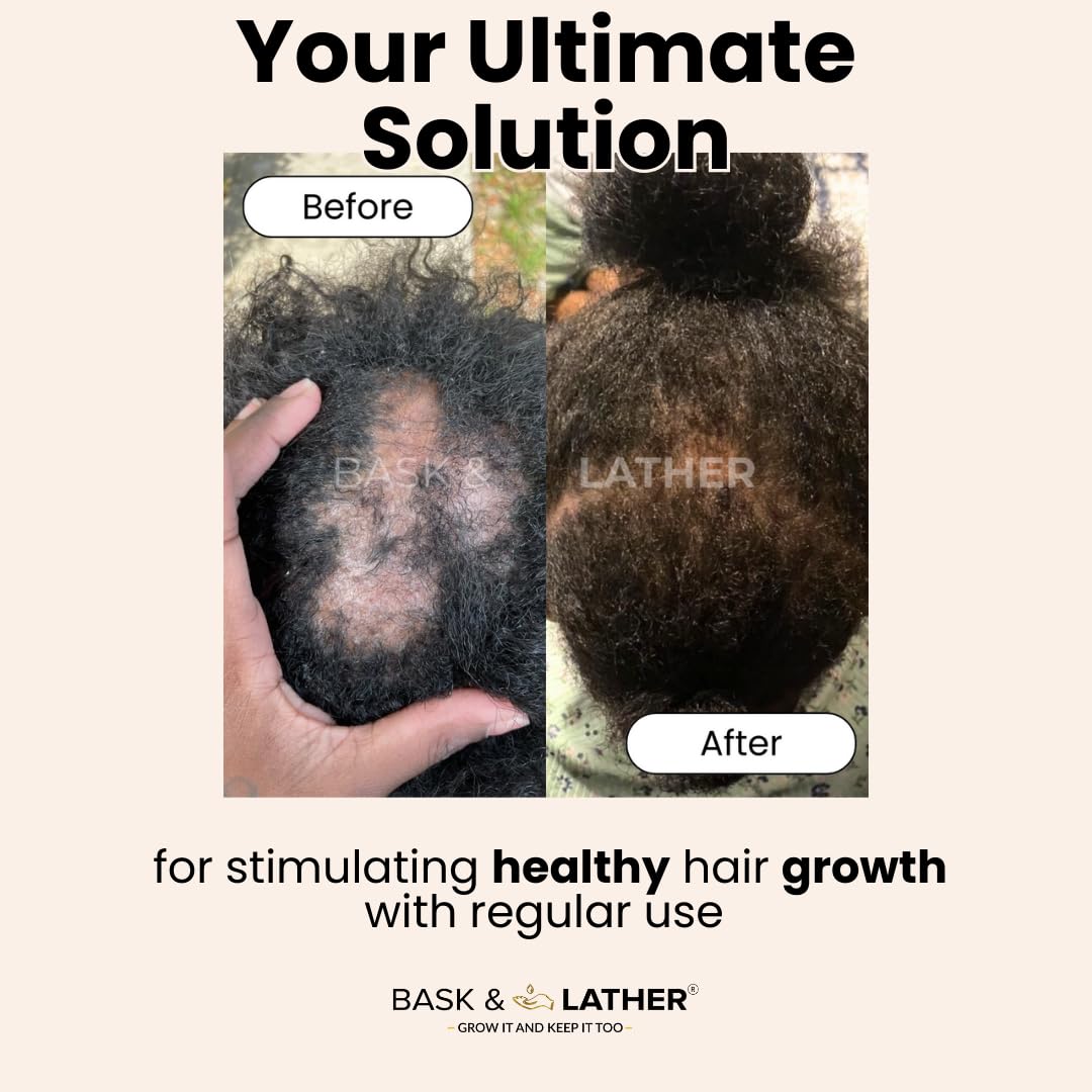 Hair Elixir & Scalp Stimulator Oil - Natural Growth Trio for Thicker, Healthier Hair | Moisturize & Soothe Scalp