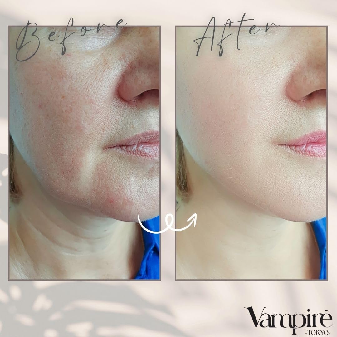Vampire TOKYO Vampire The Secret Cream, Skin at a Turning Point Rice Bran Extract Plant Ceramide High Concentration Firmness Glow Fine Lines Slow Aging Aging Skin Moisturizing Care English Version