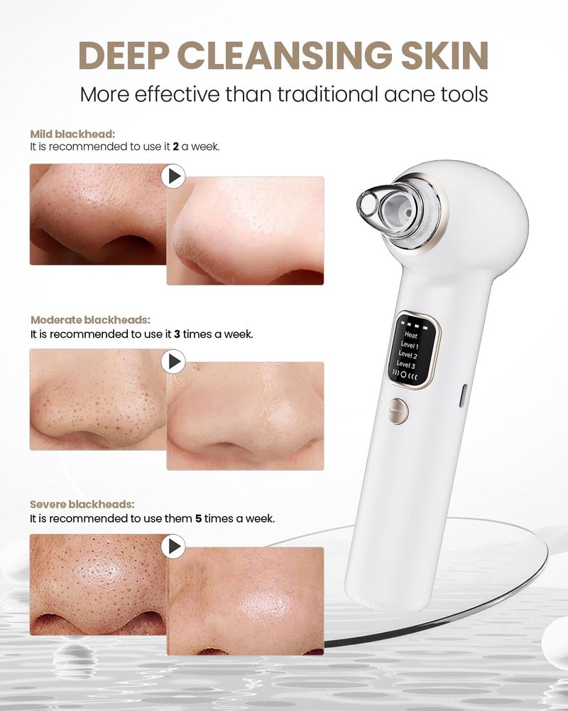 Blackhead Remover Pore Vacuum with Heating - Blackhead Extractor with 3 Adjustable Suction Levels, 5 Probes - Blackhead Remover Tools for Women & Men (White)