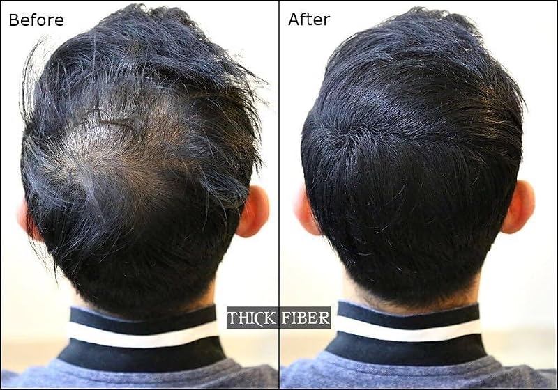 TruTress Hair Building Fibers - Black Keratin Concealer for Thinning Hair, 28g