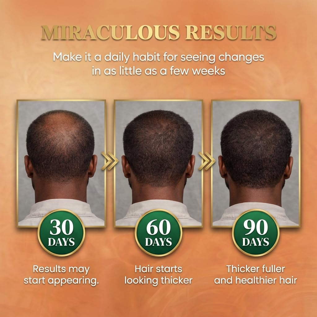 Batana Oil for Hair Growth - 100% Raw Organic Hair Mask | Promotes Thickness & Prevents Loss, 4.06 fl oz