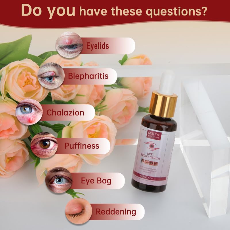 MIZEEYE 2PCS Eye Relief Serum for Blepharitis & Chalazion, Moisturizing Under Eye Care