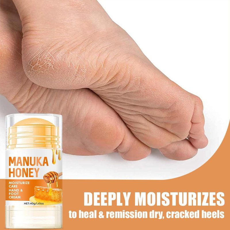 Urea Cream Stick - 60% Urea Moisturizing Treatment for Dry Cracked Skin | Hydrating Foot & Hand Care (1.41 oz)