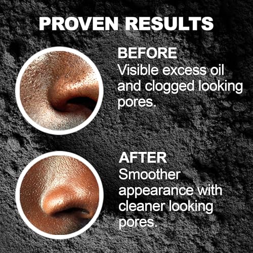 Activated Charcoal Clay Mask for Men | Deep Cleansing & Detox