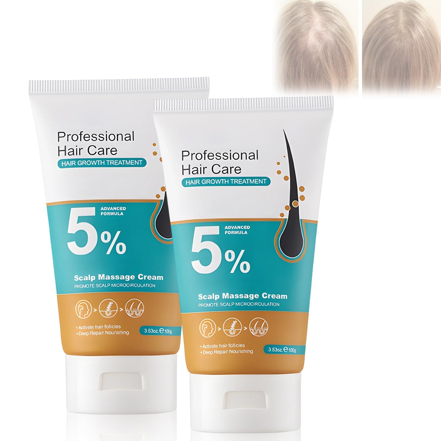 2Pcs 5% Hair Growth Scalp Massage Cream,Professional Hair Care Cream,Anti-Hair Loss with Rosemary Biotin for Men & Women,Fast Regrowth & Strengthens Hair Roots（100g）