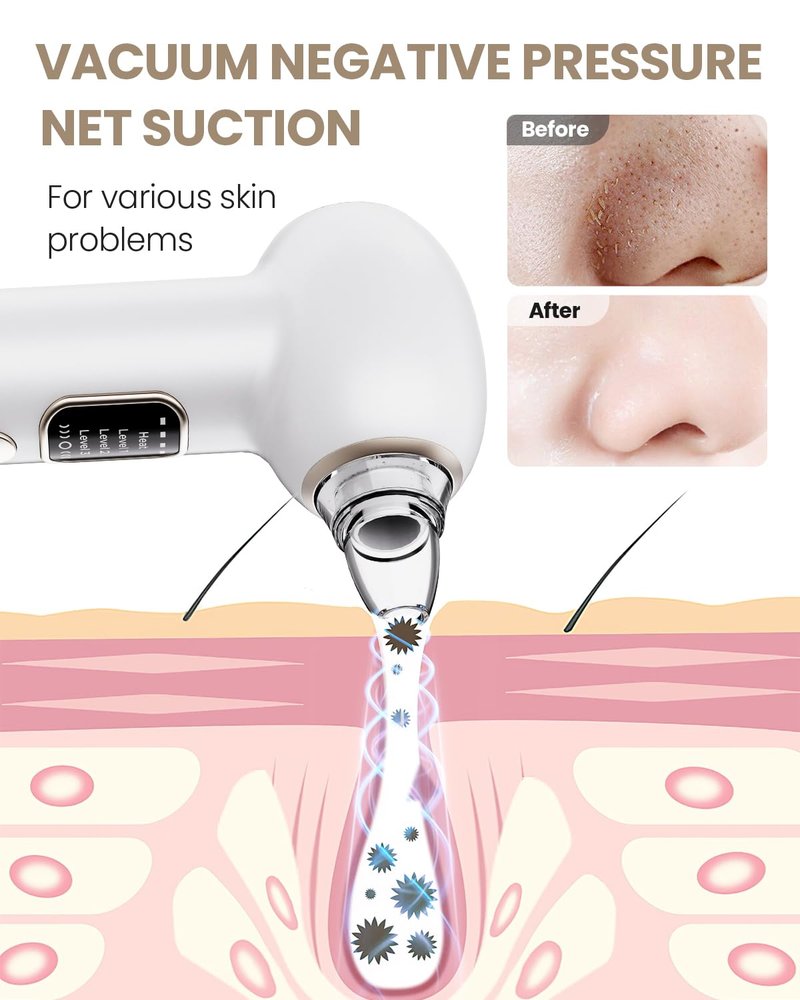 Blackhead Remover Pore Vacuum with Heating - Blackhead Extractor with 3 Adjustable Suction Levels, 5 Probes - Blackhead Remover Tools for Women & Men (White)