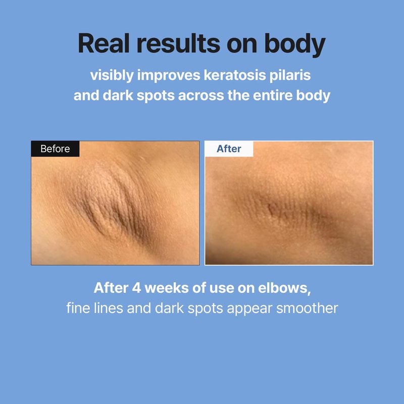 Retinal Skin Booster Serum - Anti-Aging Retinaldehyde & Niacinamide | K-Beauty Facial Serum for Fine Lines & Firming | 5.07 fl oz