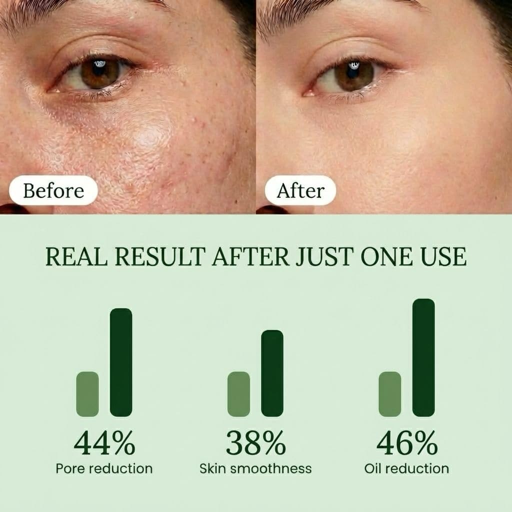 Toner Pads - Gentle Dual-Action Pore Minimizer for All Skin Types | 70 Exfoliating Textured Pads