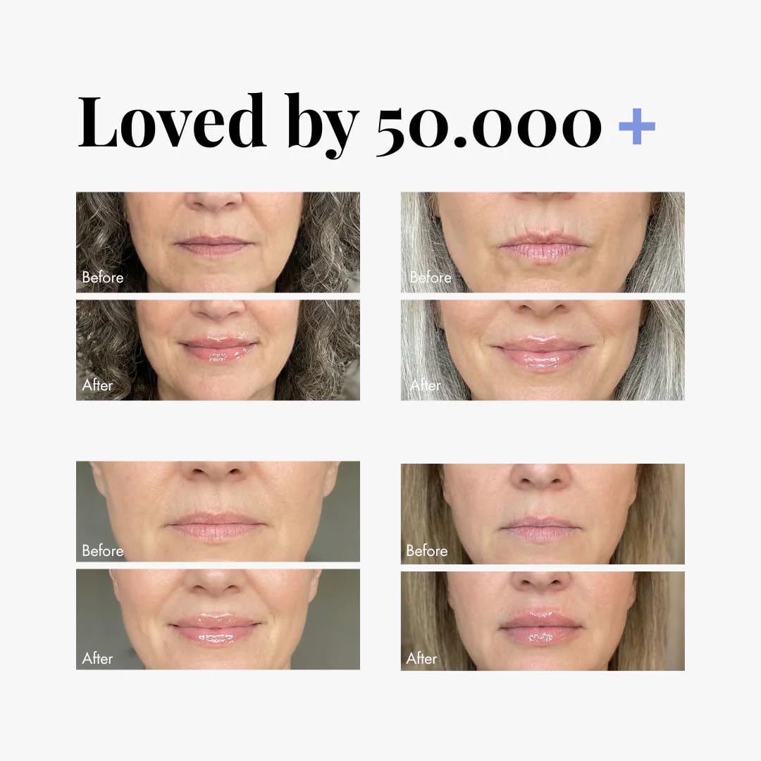 Smooche - Normal Lip Plumper