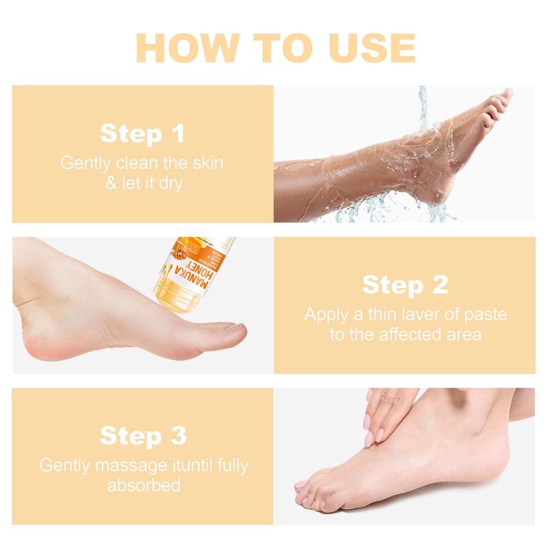 Urea Cream Stick - 60% Urea Moisturizing Treatment for Dry Cracked Skin | Hydrating Foot & Hand Care (1.41 oz)