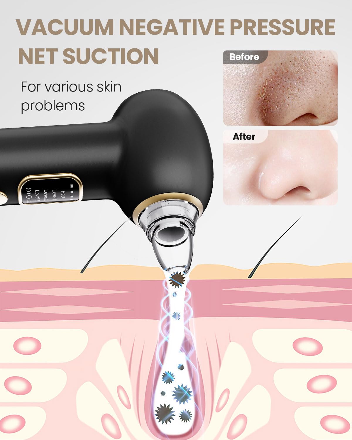 Blackhead Remover Pore Vacuum with Heating - Blackhead Extractor with 3 Adjustable Suction Levels, 5 Probes - Blackhead Remover Tools for Women & Men