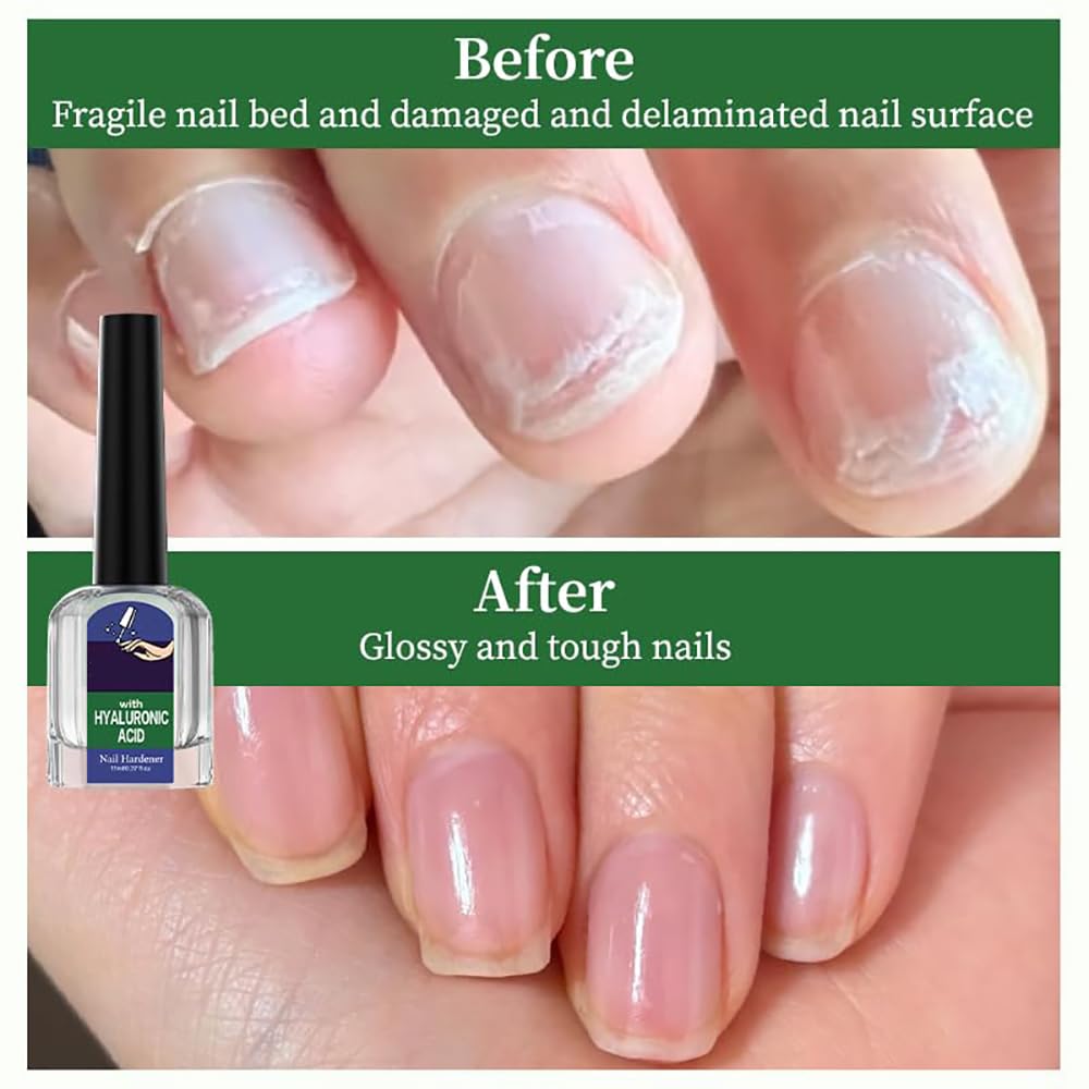 Nail Care Cuticle Oil - Fast Absorbing Repair Serum for Cracked Cuticles | 2-Pack for Home Manicures