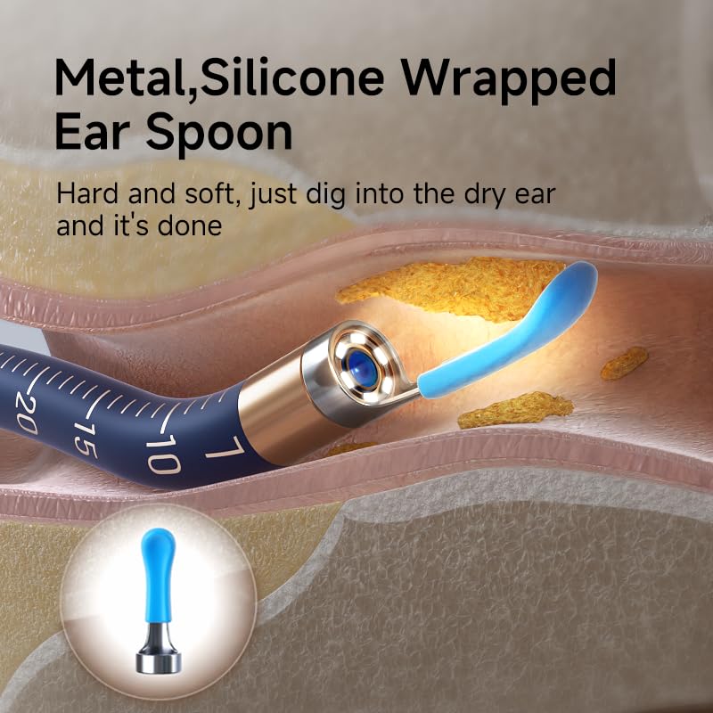 BEBIRD Replacement Tips Ear 14-Piece Silicone Ear Spoon Set for Ear Wax Removal