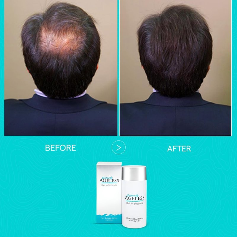 Instantly Ageless® Hair in Seconds™ Hair Building Fibers – Hair Thickening Fibers for Thinning Hair & Hair Loss for Fuller-Look - 0.83 oz (23g) - Dark Brown