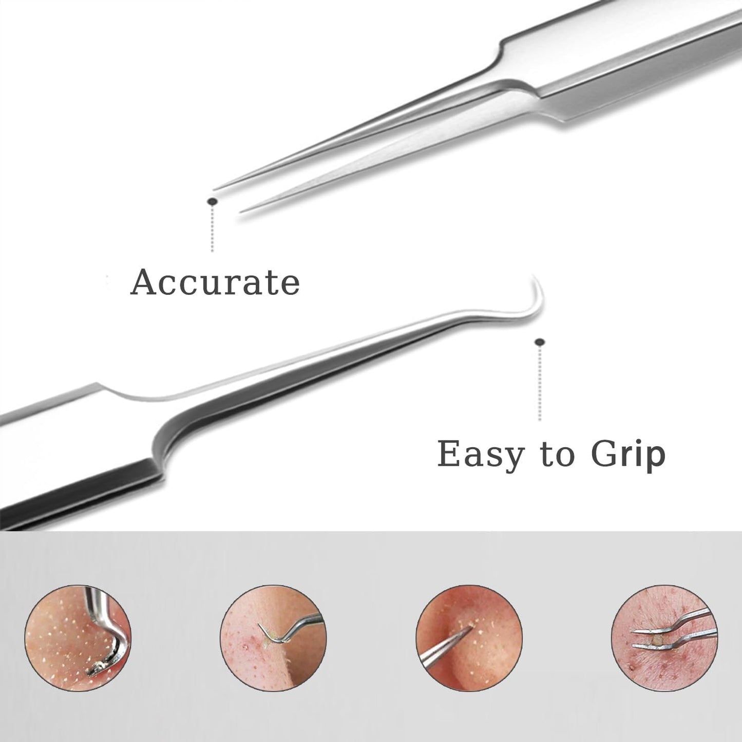 Precision Blackhead Remover Tweezers - 3-Piece Stainless Steel Pimple Popper Tool Kit | Matte Finish