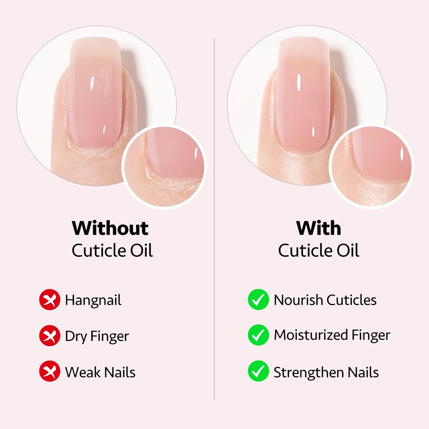 Cuticle Oil Pen Set - 6 Pcs Manicure & Pedicure Accessories with Vitamin E | Nail Growth Treatment & Repair Kit