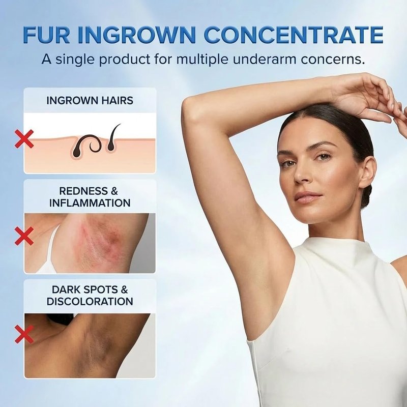 Ingrown Hair Treatment Serum – Smoothing Solution for Razor Bumps & Hair Removal Aftercare | Hydrating Care for Underarms, Legs, Bikini Line & Arms