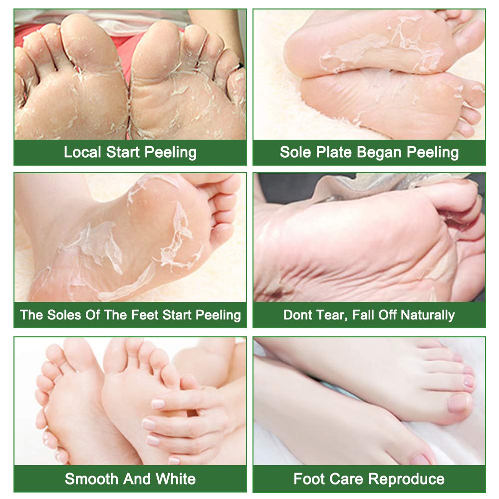 Liefiet Foot Peeling Mask 5 Pack, Foot Mask Remove Dead Skin, Rough Callus and Cracked Heels, Dry Skin Moisturizer for Soft and Smooth Baby Touch Feet (Tea Tree)