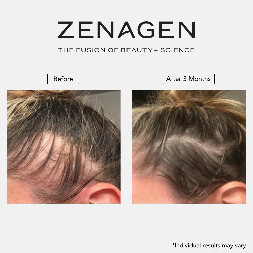 ZENAGEN Revolve Thickening Shampoo for Fine & Thinning Hair - Plant-Based, Color-Safe 5-Minute Treatment