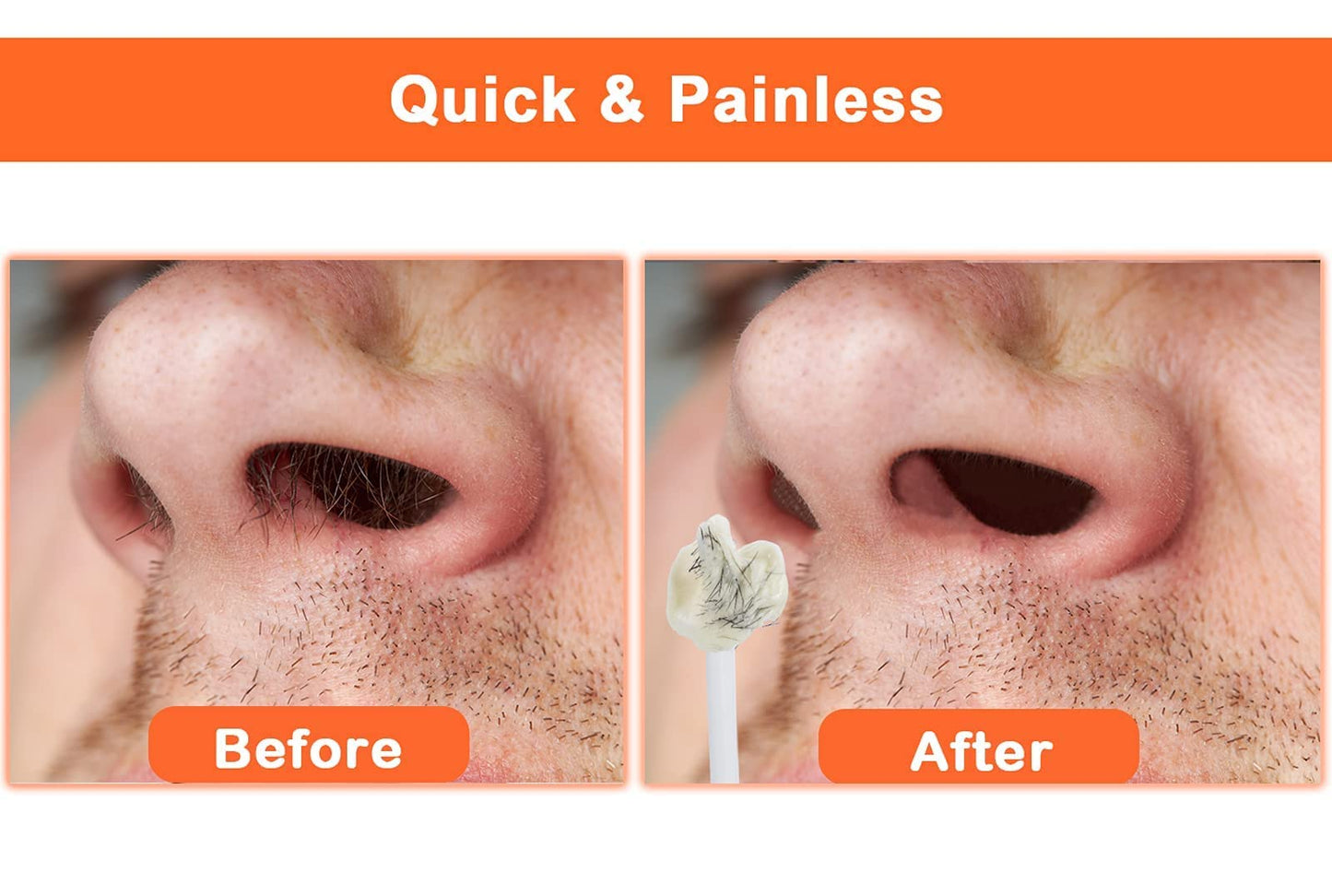 Nose Wax Kit, 120g Nose Hair Wax Kit for Men & Women, Painless Nose Hair Removal with USB Fast Heat, Smart Constant Temp, 40 Applicators, Wooden Sticks, After-Wax Wipes and Moustache Guards 20-25 Uses