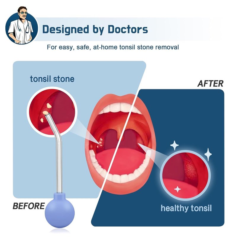 Tonsil Stone Vacuum,Best Deep Tonsils Stones Remover Vacuum Kits to Mouthwash,Stones Vacuums,Tonsils Removal Kits,Removal Kit to Serum,7 in1 Tonsil Stone Vacuums Tool.