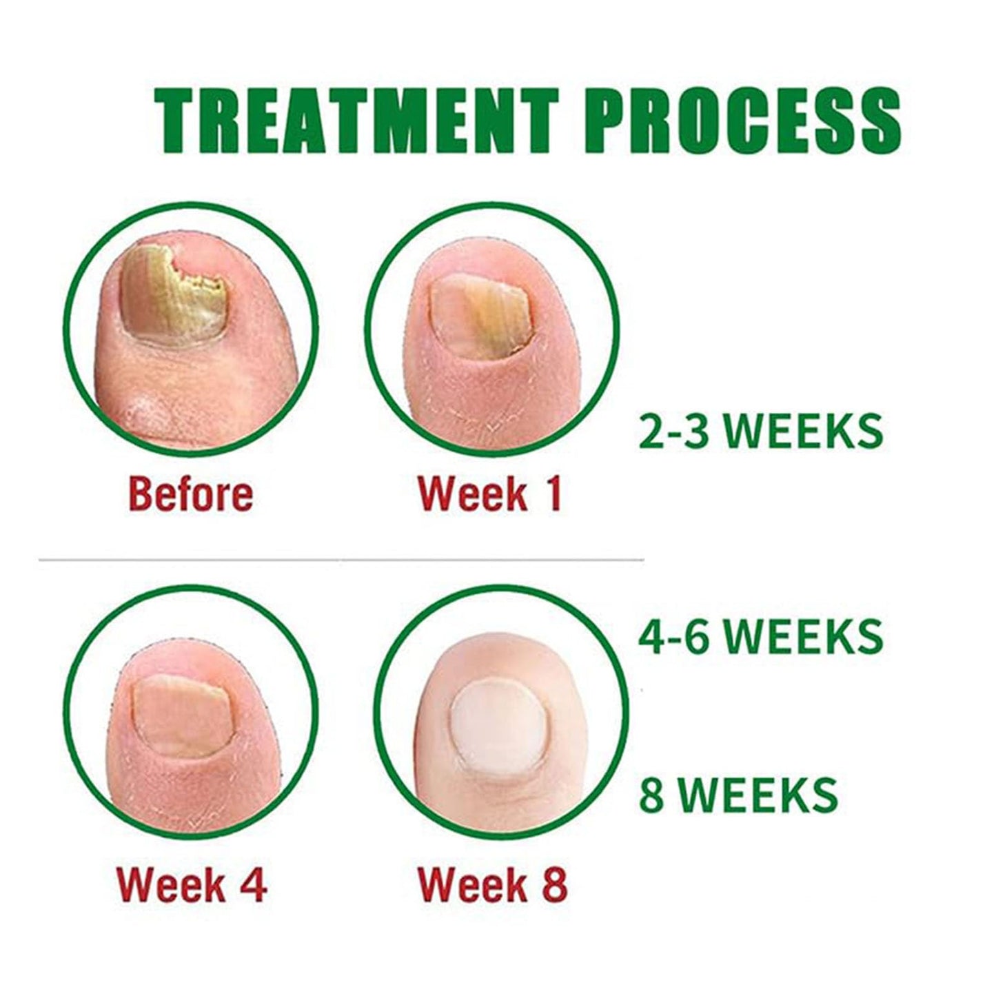 Nail Treatment Gel, Nail Growth Serum for Repair & Strengthener