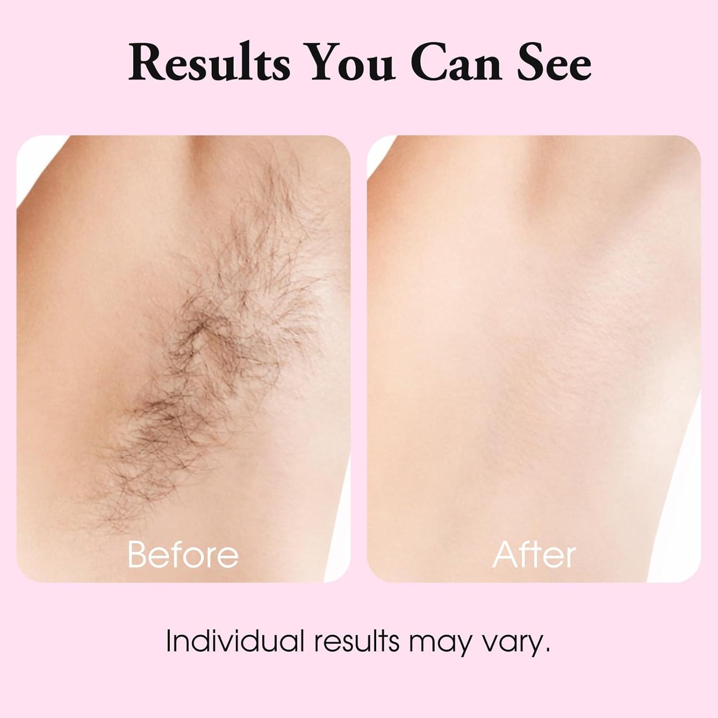 Cyperus Rotundus Oil for Hair Removal - 60ml Natural Moisturizing & Soothing Oil with Jojoba & Tea Tree for All Skin Types